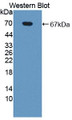 Western Blot; Sample: Recombinant protein.