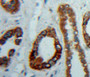 DAB staining on fromalin fixed paraffin- embedded Kidney tissue)