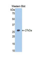 Western Blot; Sample: Recombinant protein.