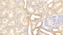 DAB staining on IHC-P; Samples: Human Kidney Tissue;  Primary Ab: 20μg/ml Rabbit Anti-Human TNFRSF14 Antibody Second Ab: 2µg/mL HRP-Linked Caprine Anti-Rabbit IgG Polyclonal Antibody 