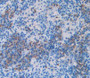 Tumor Necrosis Factor Receptor Superfamily, Member 19 Like Protein (Tnfrsf19L) Polyclonal Antibody, Cat#CAU22996