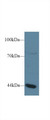 Western Blot; Sample: Human Jurkat cell lysate; Primary Ab: 1µg/ml Rabbit Anti-Human GTF3A Antibody Second Ab: 0.2µg/mL HRP-Linked Caprine Anti-Rabbit IgG Polyclonal Antibody