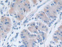 DAB staining on IHC-P; Samples: Human Stomach Tissue; Primary Ab: 20µg/ml Rabbit Anti-Human DPP7 Antibody Second Ab: 2µg/mL HRP-Linked Caprine Anti-Rabbit IgG Polyclonal Antibody