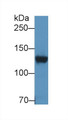 Western Blot; Sample: Rat Cerebrum lysate; Primary Ab: 2µg/ml Rabbit Anti-Human DPP6 Antibody Second Ab: 0.2µg/mL HRP-Linked Caprine Anti-Rabbit IgG Polyclonal Antibody