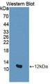 Western Blot; Sample: Recombinant protein.