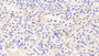 DAB staining on IHC-P; Samples: Human Kidney Tissue; Primary Ab: 20μg/ml Rabbit Anti-Human GTF2H5 Antibody Second Ab: 2µg/mL HRP-Linked Caprine Anti-Rabbit IgG Polyclonal Antibody