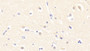 DAB staining on fromalin fixed paraffin- embedded liver tissue)