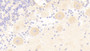 DAB staining on IHC-P; Samples: Human Cerebellum Tissue;  Primary Ab: 20μg/ml Rabbit Anti-Human IRS2 Antibody Second Ab: 2µg/mL HRP-Linked Caprine Anti-Rabbit IgG Polyclonal Antibody 