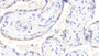 DAB staining on IHC-P; Samples: Human Placenta Tissue; Primary Ab: 20μg/ml Rabbit Anti-Human BCAT2 Antibody Second Ab: 2µg/mL HRP-Linked Caprine Anti-Rabbit IgG Polyclonal Antibody