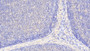 DAB staining on IHC-P; Samples: Human Lymph node Tissue; Primary Ab: 20μg/ml Rabbit Anti-Human BCAT1 Antibody Second Ab: 2µg/mL HRP-Linked Caprine Anti-Rabbit IgG Polyclonal Antibody