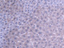 DAB staining on IHC-P; Samples: Mouse Liver Tissue;  Primary Ab: 20µg/ml Rabbit Anti-Mouse ABAT Anti