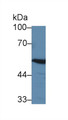 Western Blot; Sample: Rat Cerebrum lysate; Primary Ab: 3µg/ml Rabbit Anti-Human ABAT Antibody Second Ab: 0.2µg/mL HRP-Linked Caprine Anti-Rabbit IgG Polyclonal Antibody