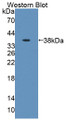 Western Blot; Sample: Recombinant protein.