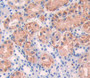 Alanine Aminotransferase 2 (Alt2) Polyclonal Antibody, Cat#CAU23037