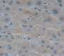 Alanine Aminotransferase 2 (Alt2) Polyclonal Antibody, Cat#CAU23038