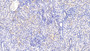 DAB staining on IHC-P; Samples: Human Kidney Tissue; Primary Ab: 20μg/ml Rabbit Anti-Human PLCL1 Antibody Second Ab: 2µg/mL HRP-Linked Caprine Anti-Rabbit IgG Polyclonal Antibody