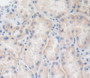 Phospholipase C Gamma 2, Phosphatidylinositol Specific (Plcg2) Polyclonal Antibody, Cat#CAU23052