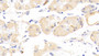 DAB staining on IHC-P; Samples: Mouse Stomach Tissue; Primary Ab: 20μg/ml Rabbit Anti-Mouse PLA2G12 Antibody Second Ab: 2µg/mL HRP-Linked Caprine Anti-Rabbit IgG Polyclonal Antibody