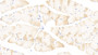 DAB staining on fromalin fixed paraffin- embedded kidney tissue)