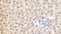 DAB staining on IHC-P; Samples: Rat Liver Tissue;  Primary Ab: 20μg/ml Rabbit Anti-Rat PLA2G3 Antibody Second Ab: 2µg/mL HRP-Linked Caprine Anti-Rabbit IgG Polyclonal Antibody 