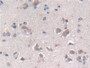 DAB staining on fromalin fixed paraffin- embedded Kidney tissue)