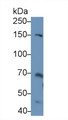 Western Blot; Sample: Mouse Heart lysate; Primary Ab: 1μg/ml Rabbit Anti-Mouse THBS2 Antibody; Second Ab: 0.2µg/mL HRP-Linked Caprine Anti-Rabbit IgG Polyclonal Antibody;