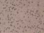 DAB staining on IHC-P; Samples: Mouse Brain Tissue;  Primary Ab: 20µg/ml Rabbit Anti-Mouse TOP2b Ant