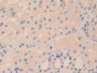 DAB staining on IHC-P; Samples: Human Kidney Tissue; Primary Ab: 10µg/ml Rabbit Anti-Human TPSd1 Antibody Second Ab: 2µg/mL HRP-Linked Caprine Anti-Rabbit IgG Polyclonal Antibody