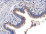 DAB staining on IHC-P; Samples: Human Lung Tissue;  Primary Ab: 20µg/ml Rabbit Anti-Human TPSb2 Antibody Second Ab: 2µg/mL HRP-Linked Caprine Anti-Rabbit IgG Polyclonal Antibody 