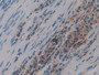 DAB staining on IHC-P; Samples: Human Lung Tissue; Primary Ab: 10µg/ml Rabbit Anti-Human VP Antibody Second Ab: 2µg/mL HRP-Linked Caprine Anti-Rabbit IgG Polyclonal Antibody