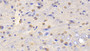 DAB staining on IHC-P; Samples: Rat Cerebrum Tissue;  Primary Ab: 20μg/ml Rabbit Anti-Rat GS Antibody Second Ab: 2µg/mL HRP-Linked Caprine Anti-Rabbit IgG Polyclonal Antibody 