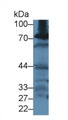 Western Blot; Sample: Rat Kidney lysate; Primary Ab: 2µg/ml Rabbit Anti-Rat GCLC Antibody Second Ab: 0.2µg/mL HRP-Linked Caprine Anti-Rabbit IgG Polyclonal Antibody