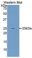 Western Blot; Sample: Recombinant protein.