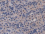 DAB staining on IHC-P; Samples: Rat Intestine Tissue; Primary Ab: 20µg/ml Rabbit Anti-Rat GCLC Antibody Second Ab: 2µg/mL HRP-Linked Caprine Anti-Rabbit IgG Polyclonal Antibody