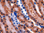 DAB staining on IHC-P; Samples: Rat Kidney Tissue;  Primary Ab: 10µg/ml Rabbit Anti-Rat GSS Antibody