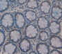 Used in DAB staining on fromalin fixed paraffin- embedded Kidney tissue