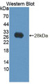 Western Blot; Sample: Recombinant protein.