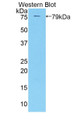 Western Blot; Sample: Recombinant protein.