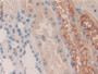 DAB staining on IHC-P; Samples: Human Kidney Tissue; Primary Ab: 10µg/ml Rabbit Anti-Human KIR2DS2 Antibody Second Ab: 2µg/mL HRP-Linked Caprine Anti-Rabbit IgG Polyclonal Antibody