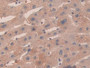 DAB staining on fromalin fixed paraffin- embedded kidney tissue)