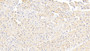 DAB staining on IHC-P; Samples: Human Cardiac Muscle Tissue;  Primary Ab: 20μg/ml Rabbit Anti-Human DBI Antibody Second Ab: 2µg/mL HRP-Linked Caprine Anti-Rabbit IgG Polyclonal Antibody 