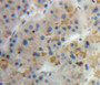 DAB staining on fromalin fixed paraffin-embedded liver tissue)