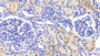 DAB staining on fromalin fixed paraffin- embedded kidney tissue)