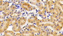 DAB staining on IHC-P; Samples: Mouse Kidney Tissue; Primary Ab: 10μg/ml Rabbit Anti-Mouse HADH Antibody Second Ab: 2µg/mL HRP-Linked Caprine Anti-Rabbit IgG Polyclonal Antibody