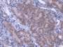 DAB staining on IHC-P; Samples: Mouse Kidney Tissue; Primary Ab: 20µg/ml Rabbit Anti-Mouse ACADS Antibody Second Ab: 2µg/mL HRP-Linked Caprine Anti-Rabbit IgG Polyclonal Antibody
