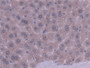 DAB staining on fromalin fixed paraffin- embedded kidney tissue)