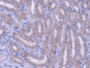 DAB staining on IHC-P; Samples: Rat Kidney Tissue; Primary Ab: 20µg/ml Rabbit Anti-Rat ABCG8 Antibody Second Ab: 2µg/mL HRP-Linked Caprine Anti-Rabbit IgG Polyclonal Antibody