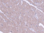 DAB staining on fromalin fixed paraffin- embedded liver tissue)