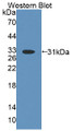 Western Blot; Sample: Recombinant protein.