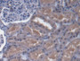 DAB staining on IHC-P; Samples: Human Kidney Tissue;  Primary Ab: 20µg/ml Rabbit Anti-Human ABCD4 An